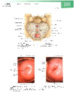 Sobotta  Atlas of Human Anatomy  Trunk, Viscera,Lower Limb Volume2 2006, page 212